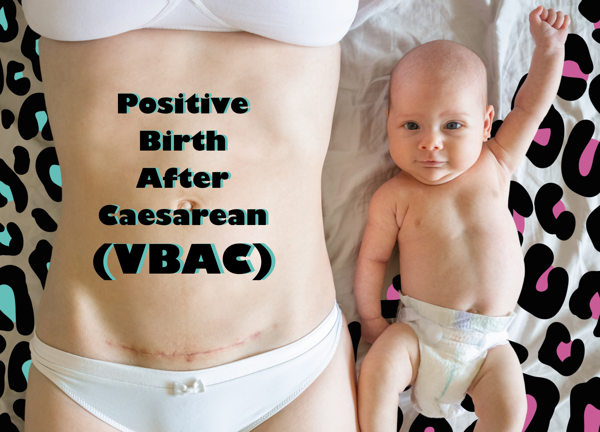 POSITIVE BIRTH AFTER CAESAREAN (VBAC)